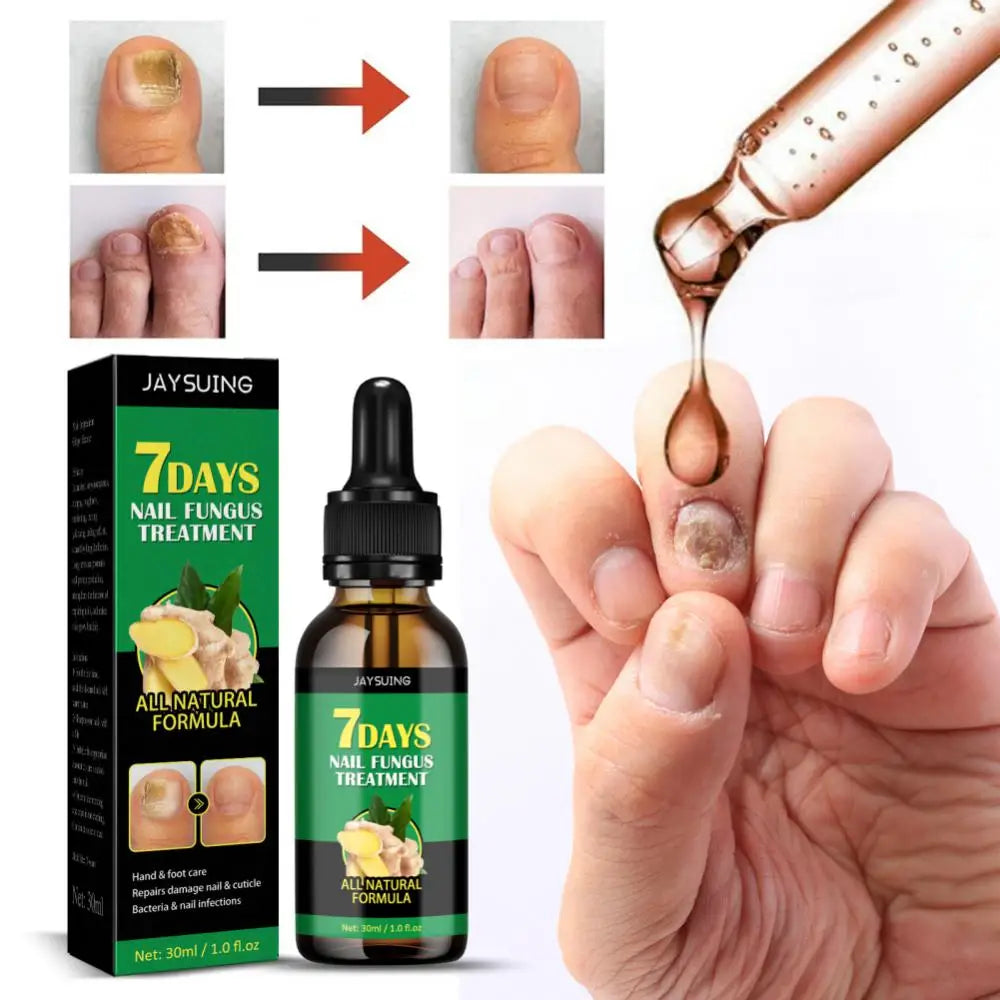 ⭐TRATAMIENTO PARA HONGOS SEVEN DAYS NAIL FUNGUS👨‍⚕️